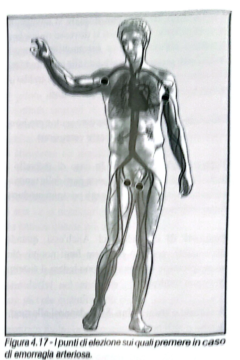 Figura 4.17 - Punti di elezione emorragia