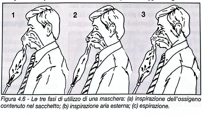Figura 4.6 - Fasi di utilizzo maschera